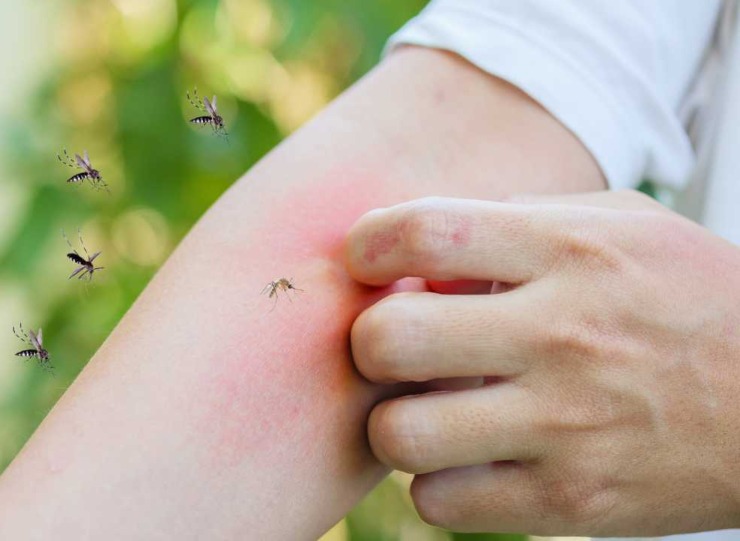 West Nile Virus
